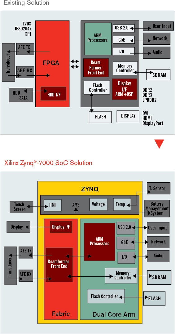 zynq-single-chip-ultrasound